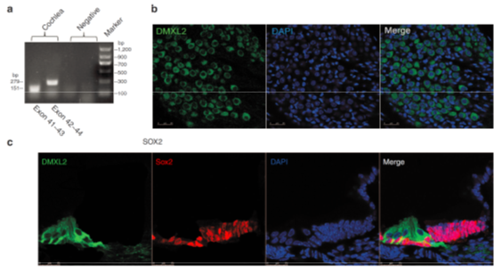 全外顯子組測(cè)序數(shù)據(jù)分析內(nèi)容 3