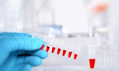 生物標志物平臺