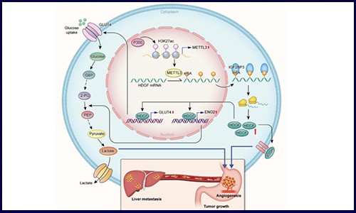 IF>10│常見腫瘤 RNA m6A 修飾研究的發(fā)文套路解析