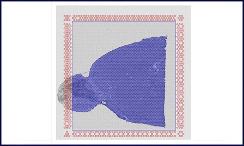 空間轉(zhuǎn)錄組 | 專業(yè)的 10x 空間轉(zhuǎn)錄組 summary 網(wǎng)頁報(bào)告解讀