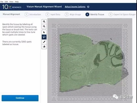 單細(xì)胞測序空間轉(zhuǎn)錄組分析軟件安裝圖示 12