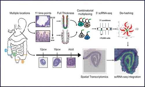 強強聯手 | 單細胞測序 & 空間轉錄組測序揭示腸道發育