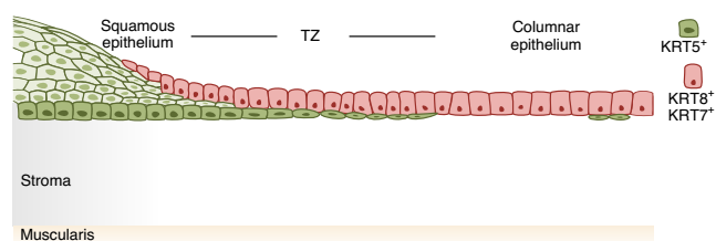 宮頸的鱗狀和柱狀譜系以及過渡區的示意圖