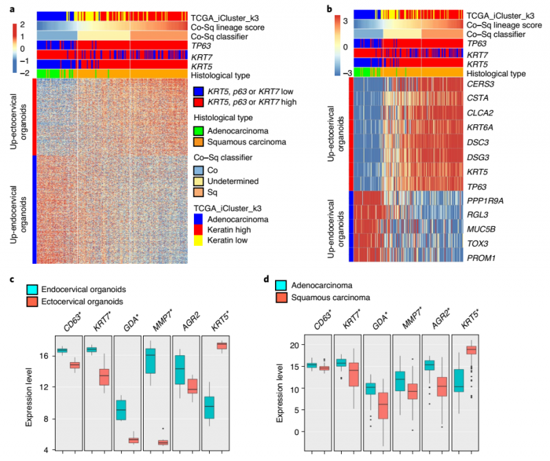 宮頸癌 SCC 和 ADC 的轉錄特征與鱗狀和柱狀上皮譜系相關