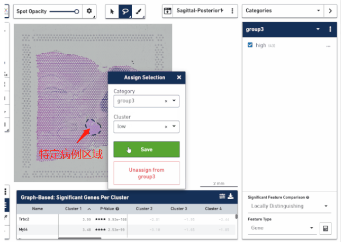 根據病理信息選取特定區域分析