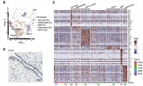 單細胞測序加速藥物研發 | 藥物靶點發現及驗證！