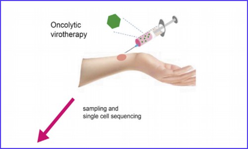 文獻解讀 | 應用單細胞測序技術研究溶瘤病毒的治療作用機制