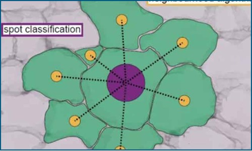 空間轉錄組聯合單細胞 RNA 測序技術 | 揭示對胰島素有明顯敏感性的人類脂肪細胞亞群