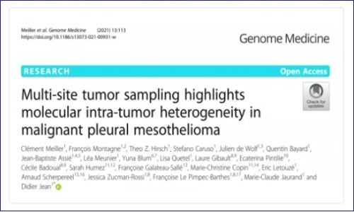 多組學文獻解析丨多組學揭示惡性胸膜間皮瘤異質性