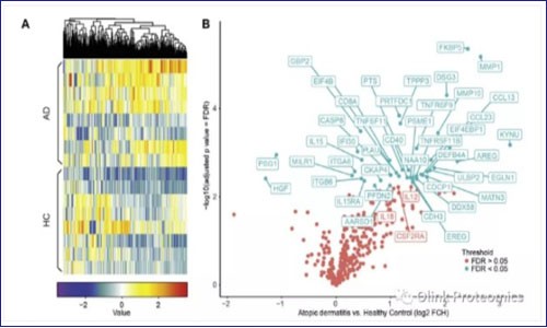 JACI – Olink 高敏微量體液蛋白質組與單細胞轉錄組共同助力開發特應性皮炎（AD）檢測新方法