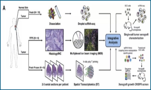 單細胞 + 空間轉錄組 | 多組學探究人鱗狀上皮癌腫瘤微環境