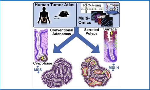 Cell 發表結直腸癌前病變多組學圖譜，揭示兩種常見結直腸息肉的不同癌變路徑