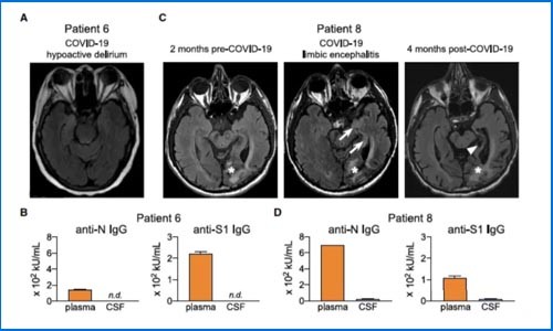 干貨解讀 |Olink 助力癌癥患者感染 COVID-19 后引發神經障礙機制研究