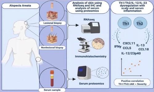 Olink 科研文獻 | 血清標志物為實現斑禿無創診斷和靶向治療提供新希望