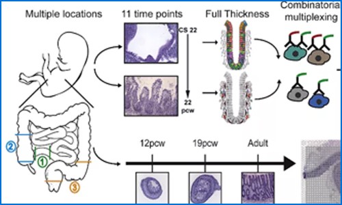 多組學聯合 | 單細胞測序聯合空間轉錄組繪制人類腸道時空發育圖譜