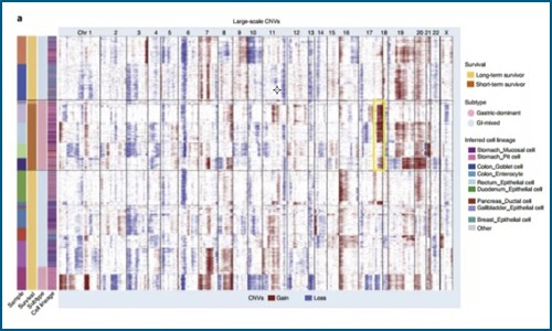 單細胞測序 | 單細胞測序技術揭示轉移性胃腺癌的瘤內異質性和譜系多樣性