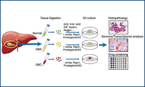 項目文章 | 伯豪生物單細胞測序分析助力類器官膽囊癌建模和藥物篩選