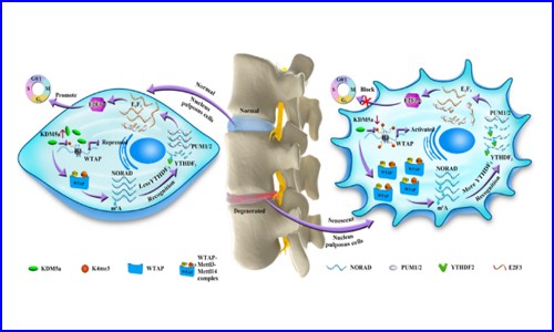 文獻解讀 |WTAP 介導的 lncRNA NORAD 的 m6A 修飾促進椎間盤退變（IVDD）