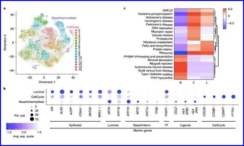 文獻解讀 | 單細胞測序研究人類前列腺癌