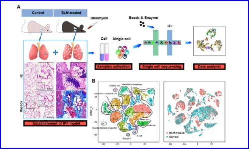 文獻解讀 | 單細胞 RNA 測序鑒定博萊霉素誘導的肺纖維化中內皮細胞的異質性