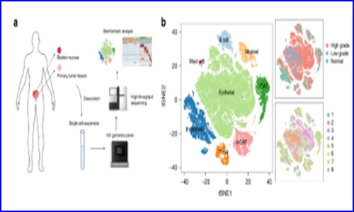 文獻解讀 | 單細胞測序研究膀胱癌中癌癥相關成纖維細胞