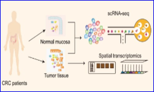 空轉實驗文章 NC- 上海免疫所蘇冰 / 葉幼瓊團隊揭示結直腸癌腫瘤邊界間質細胞與巨噬細胞互作模式