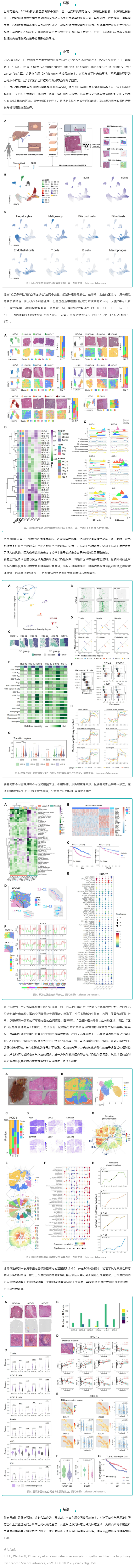 文獻解讀_空間多組學揭示原發性肝癌空間異質性圖譜