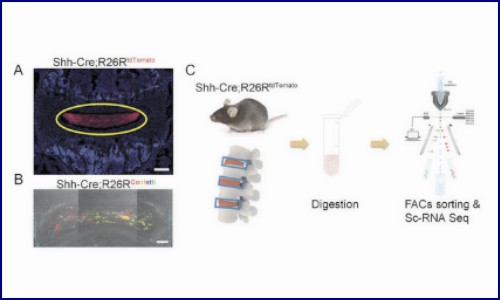 文獻解讀 | 鑒定和應用髓核前體細胞治療椎間盤退變