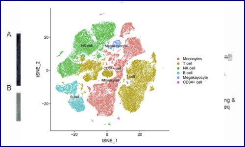 項目文章 | 單細胞 RNA 測序揭示急性心肌梗死的循環免疫圖譜