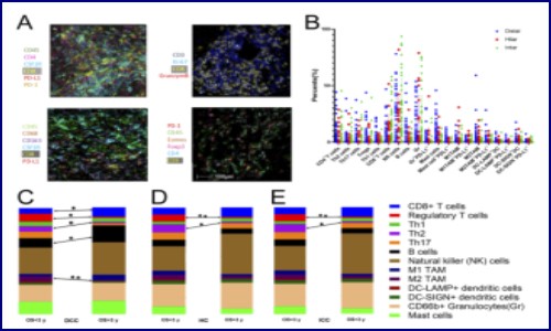 文獻解讀 | 膽管癌的免疫細胞圖譜揭示不同的腫瘤微環境和相關預后的關系