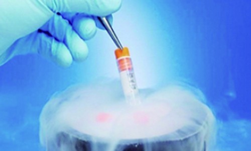 單細胞全長轉(zhuǎn)錄本測序 | 樣品的選擇與實驗細節(jié)