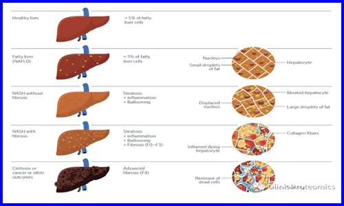 Nat Gen 干貨 |deCODE genetics 團隊借助 Olink Explore 對 NAFLD 患者進行多組學研究