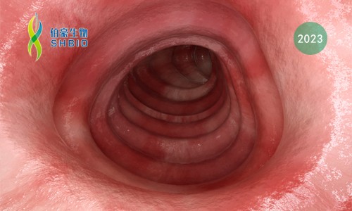 文獻(xiàn)解讀 | 潰瘍性結(jié)腸炎患者回腸 - 肛管袋免疫細(xì)胞的單細(xì)胞轉(zhuǎn)錄研究