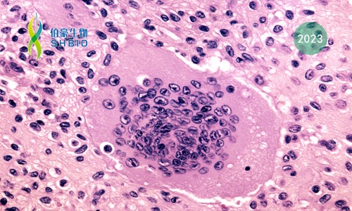 文獻解讀 | 單細胞分辨率下破骨細胞形成過程