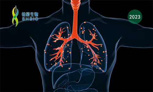 項目文章 | 張鵬 / 王晨飛合作揭示非小細胞肺癌的微環(huán)境在免疫治療中的動態(tài)變化