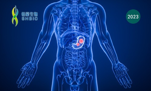 Cell 子刊 | 基于單細胞轉(zhuǎn)錄組測序數(shù)據(jù)，揭示胃腺癌進展過程中免疫、基質(zhì)細胞狀態(tài)及生態(tài)型演變