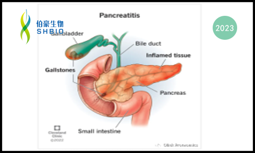 新文速遞 |Olink 蛋白組學(xué)助力貝勒醫(yī)學(xué)院大型前瞻性胰腺炎血清免疫譜新發(fā)現(xiàn)