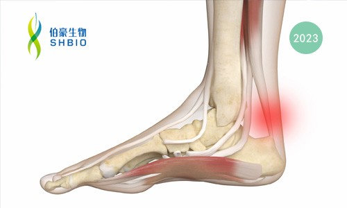 mRNA-seq 項目文章 | 高拉伸聚酯基壓電彈性體同時實現(xiàn)跟腱斷裂加速再生和運動監(jiān)測