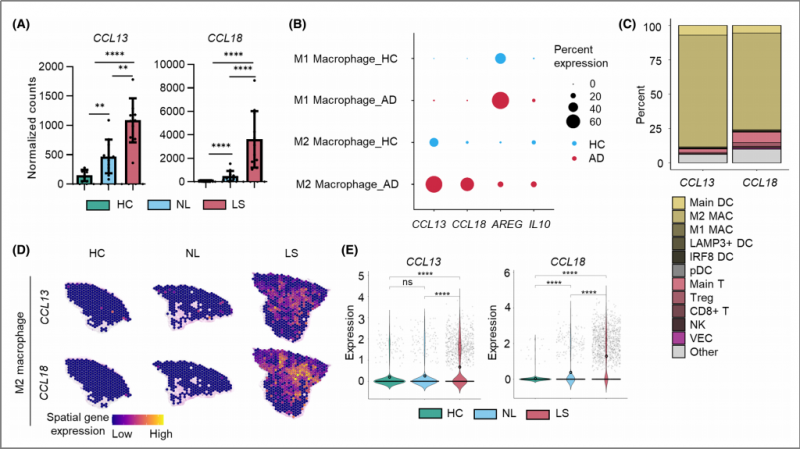 空間轉(zhuǎn)錄組測序 + 單細(xì)胞測序 + 蛋白組學(xué)測序 SCI 文章圖 3