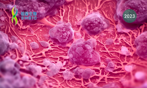 文獻解讀 | MFN2 介導(dǎo)的線粒體 - 內(nèi)質(zhì)網(wǎng)接觸通過維持線粒體鈣穩(wěn)態(tài)增強 CD8+ T 細胞在腫瘤微環(huán)境中的代謝適應(yīng)和效應(yīng)功能