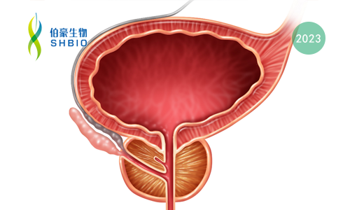 文獻解讀 | 在肺癌和前列腺癌中，通過下調(diào) SOX2 抑制 Exportin 1 從而抑制神經(jīng)內(nèi)分泌轉(zhuǎn)化