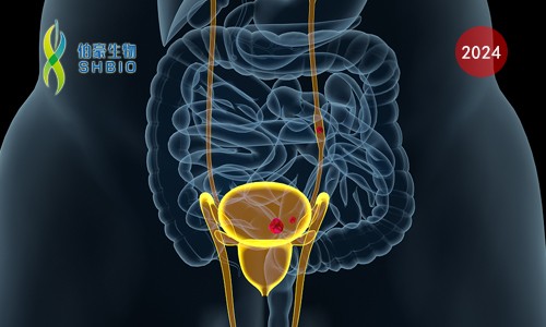 Nat Med 臨床 II 期案例 |Olink 蛋白組學助力膀胱癌患者分層以推進精準診療