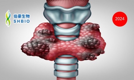 文獻(xiàn)解讀 | 甲狀腺癌去分化的綜合分析