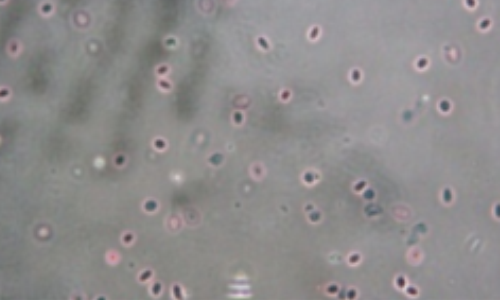 人肺組織樣本應(yīng)用試劑效果圖