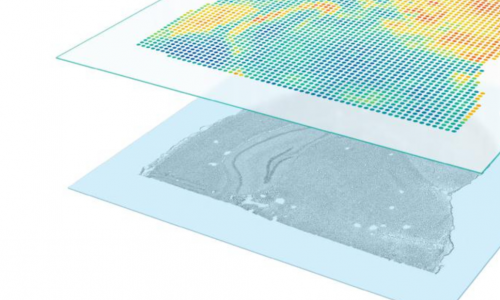 七月高分文獻(xiàn)速遞 | 空間轉(zhuǎn)錄組系列