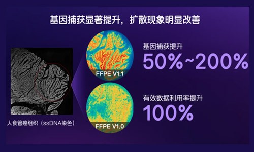 臨床科研新利器！納米級時空轉(zhuǎn)錄組 FFPE V1.1 預(yù)售啟動，解鎖研究新可能